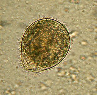 Balantidium protozooaren parasito handiena da