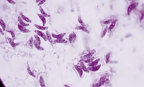 protozooa parasitoa toxoplasma gondii toxoplasmosiaren eragilea