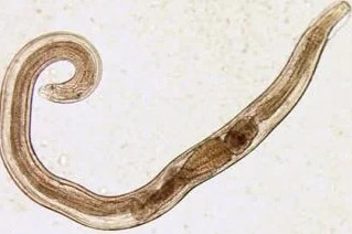 giza parasitoak pinworm